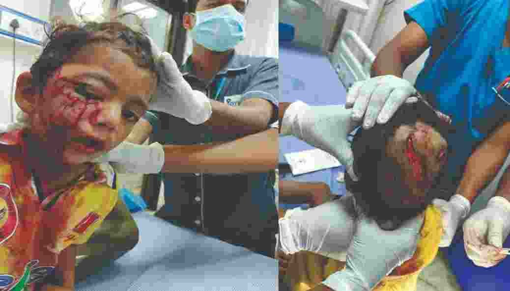 Bibatya attack on five-year-old girl